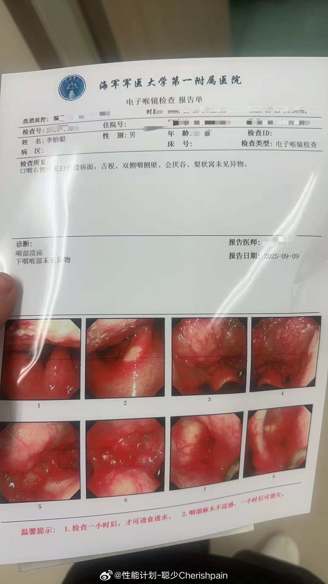 这辈子除了三文鱼，基本不会再吃鱼了前两天在成都出差，山路拍摄结束饿得一匹，到了吃