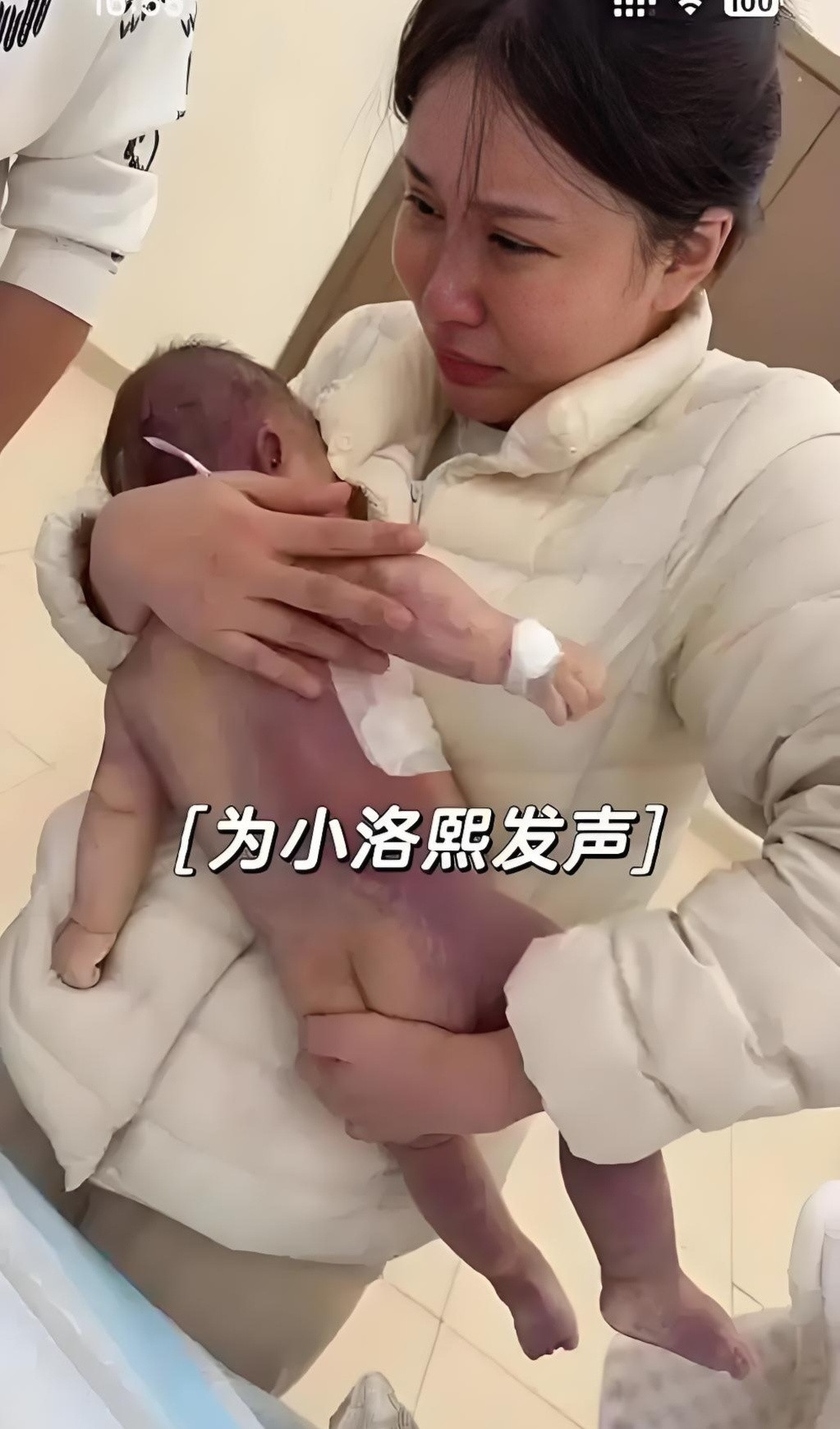 小洛熙就这样死在了冰冷的，只放着一张隔尿垫的台子上，全身紫青色，身上光溜溜，没有