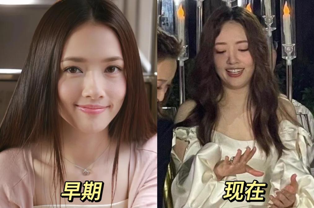 果然是财能养人啊，郭碧婷和奚梦瑶嫁入豪门前后对比，不能说差距大，只能说是“判若两
