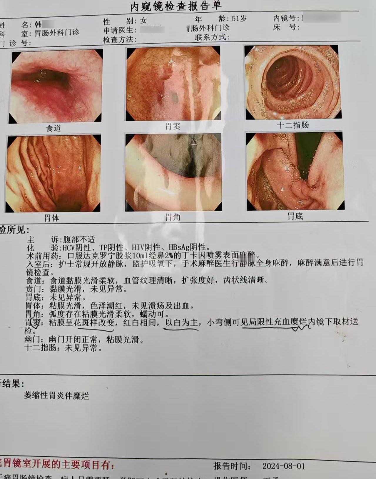 萎缩性胃炎伴肠化，吃中药有用吗？听听脾胃专家怎么说！对于已经确诊“慢性萎缩性