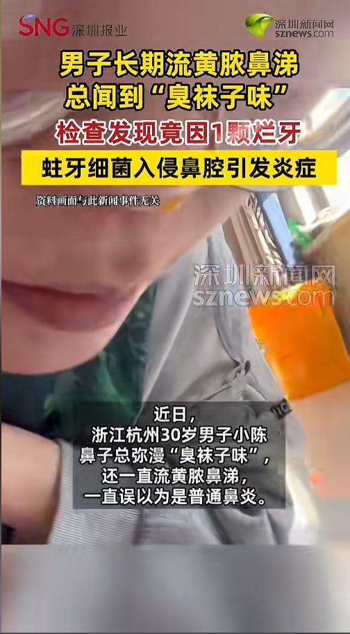 “小毛病也不要拖！”4月28日报道，浙江杭州，一男子老是流黄浓鼻涕，鼻子里还一股