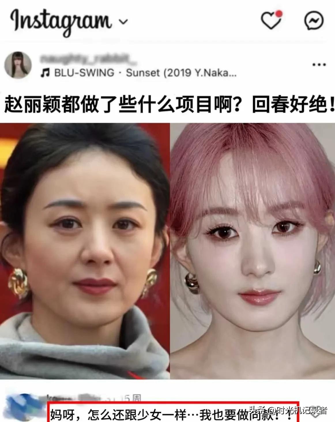 赵丽颖只不过是瘦了，加上化妆美颜，赵丽颖真是唯一没有多大变化的女艺人。如今娱乐