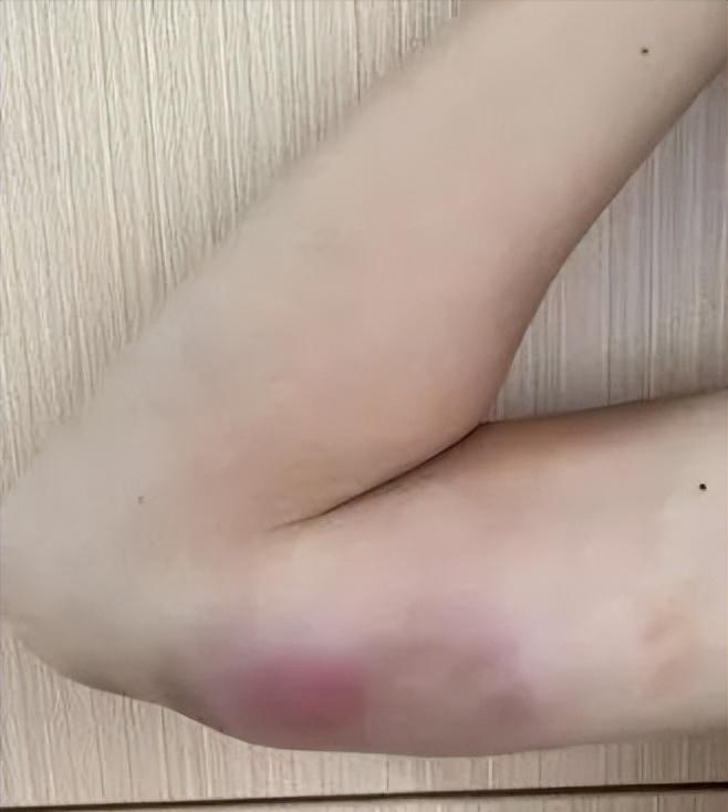 🌞9月9日报道，福建福州，一13岁男孩多次对流浪猫进行投喂，结果手臂上突然