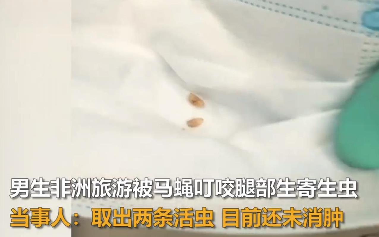 4月22日，南京的高同学在非洲旅游时被马蝇咬伤腿部，回国后涂抹了药物伤口逐渐结痂