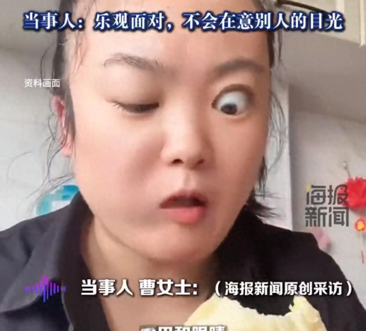 黑龙江鸡西女子意外走红！5月8日一位曹女士吃东西瞬间秒变大小眼，当事人曹女
