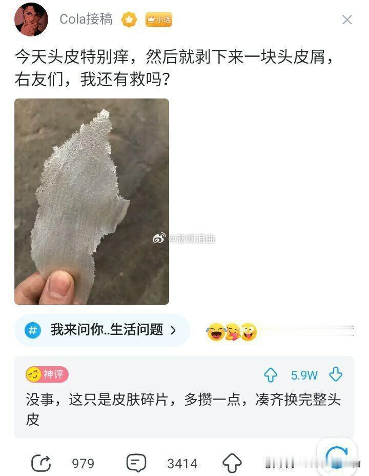 救命！我只是想抠个头皮屑