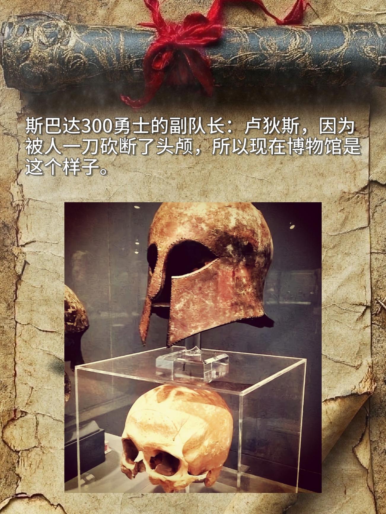 斯巴达300勇士的副队长：卢狄斯，因为被人一刀砍断了头颅，所以现在博物...