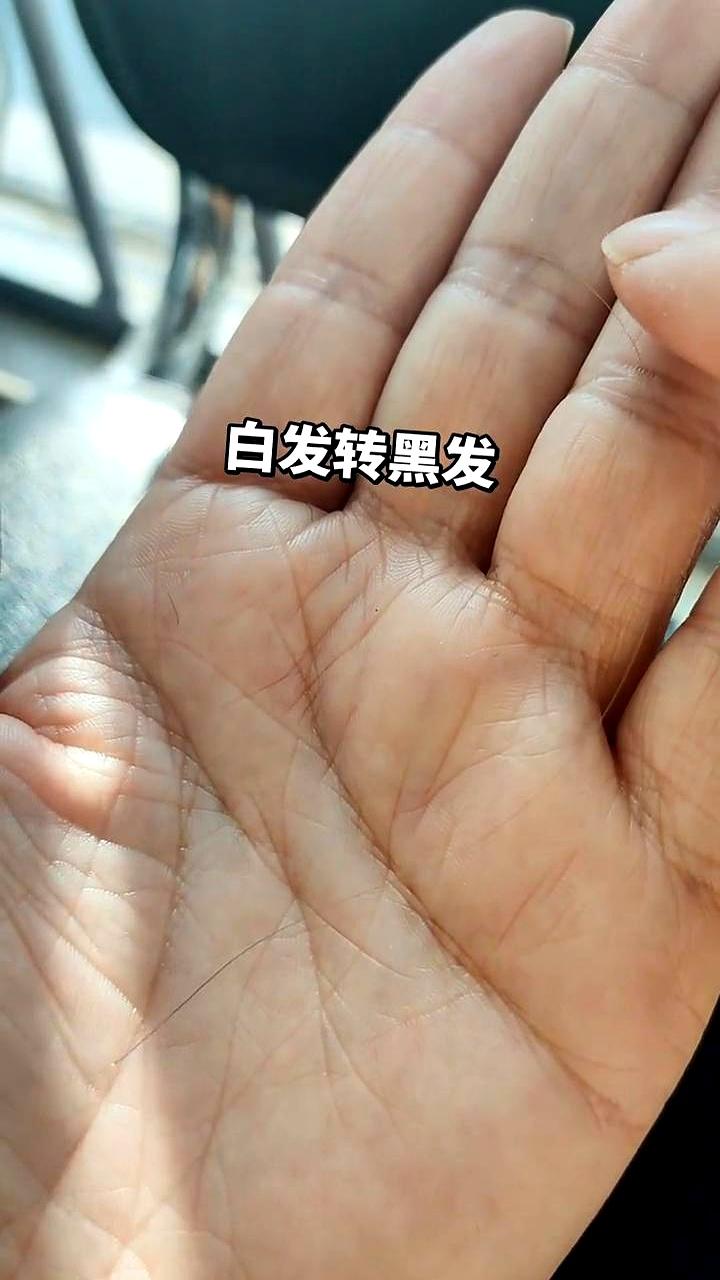 “姐妹们！我白头发居然偷偷返场了！”一位博主晒图：发根从雪白变灰再变深，