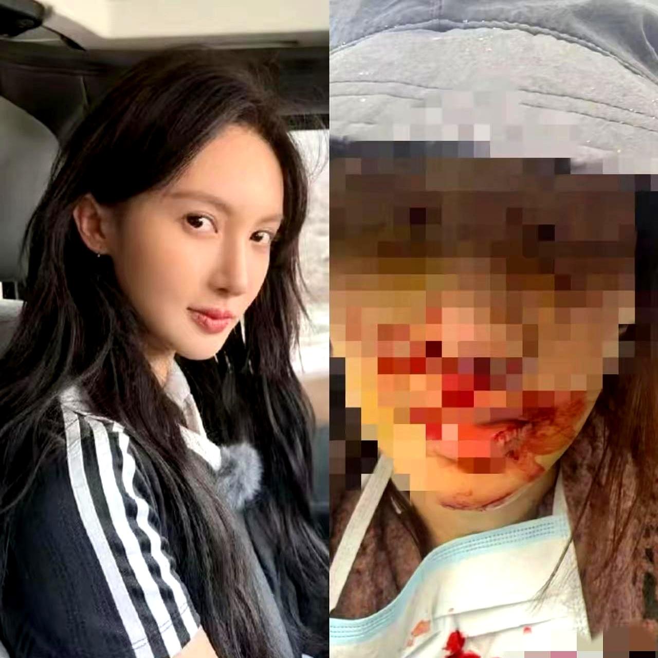 表姐在美容院摸爬滚打十几年，这次算是把话讲透了。金晨在绍兴撞伤了脸，愣是不敢在