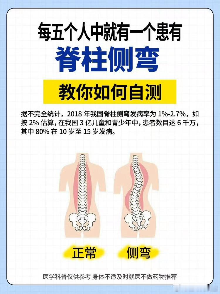看演唱会发现自己脊柱侧弯了我去看来看看