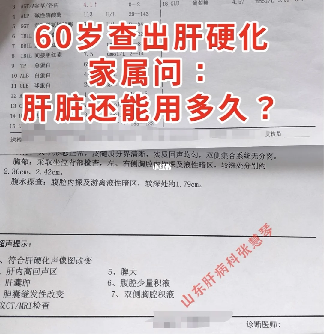 60岁老人查出肝硬化，家属问了这样一个问题