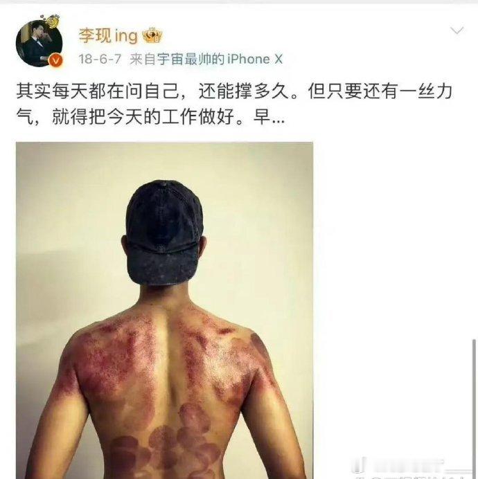 李现微博多分享工作、生活感悟及公益活动，如拍鸟、徒步等，较正式；朋友圈则更私密，
