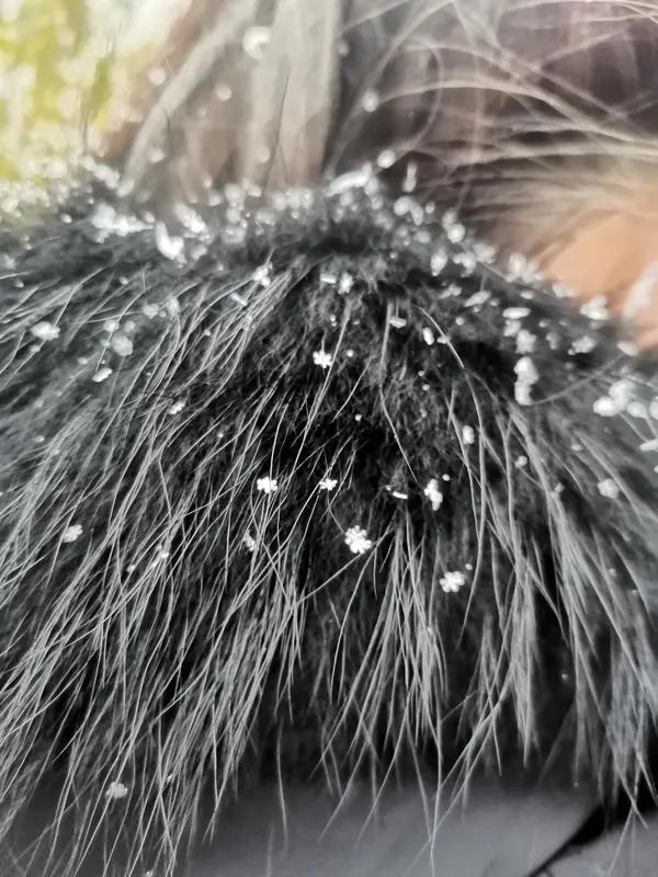 头皮屑多真的很烦人，一抓就像下雪一样。其实，头屑多可能是正常现象，也可能是脂溢性