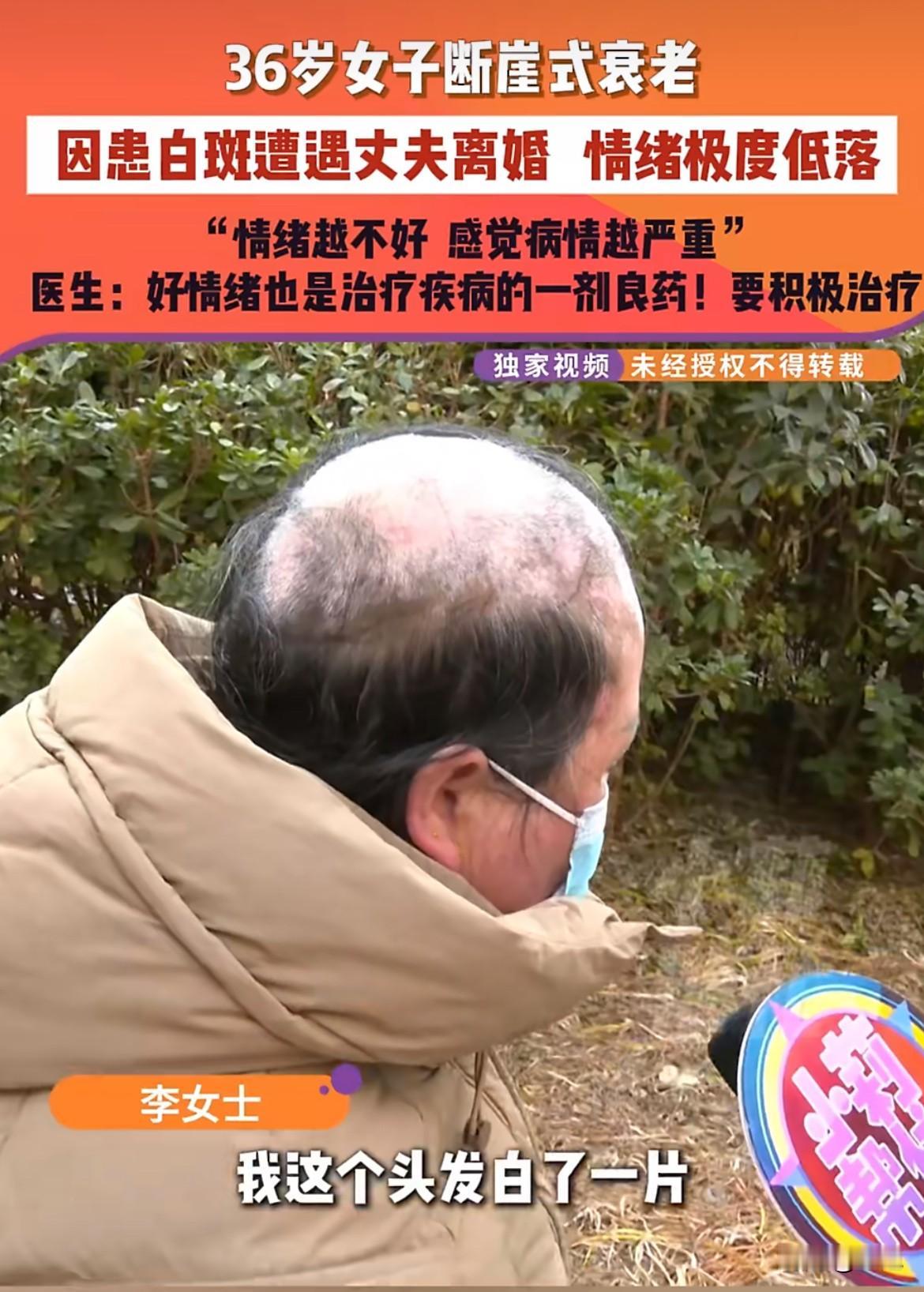 三十六岁的李女士，结婚十六年，怎么也没想到，一场病会把她的人生劈成两半。两年