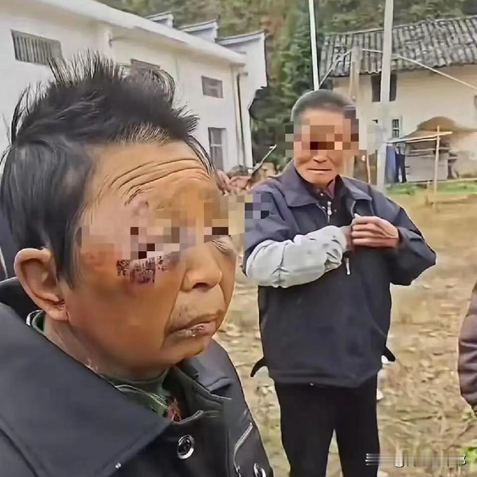 要湖南那位被75岁丈夫家暴的女子离婚太难了！她已经70多岁，这辈子也就跟