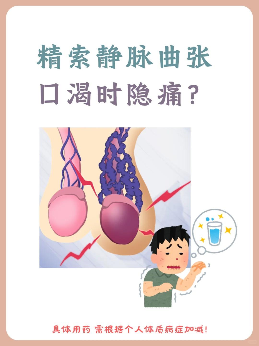 【精索静脉曲张，口渴时隐痛，是怎么回事？】精索静脉曲张在中医属“筋