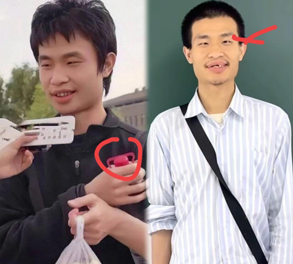 这些年数学钻研，韦东奕的面相都变了，曾经的翩翩少年，现在脸上看起来也有一些责