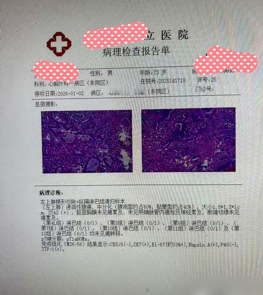 我爸那张病理报告，今天终于出来了。浸润性肺腺癌。虽然这五个字看着挺吓人，但医