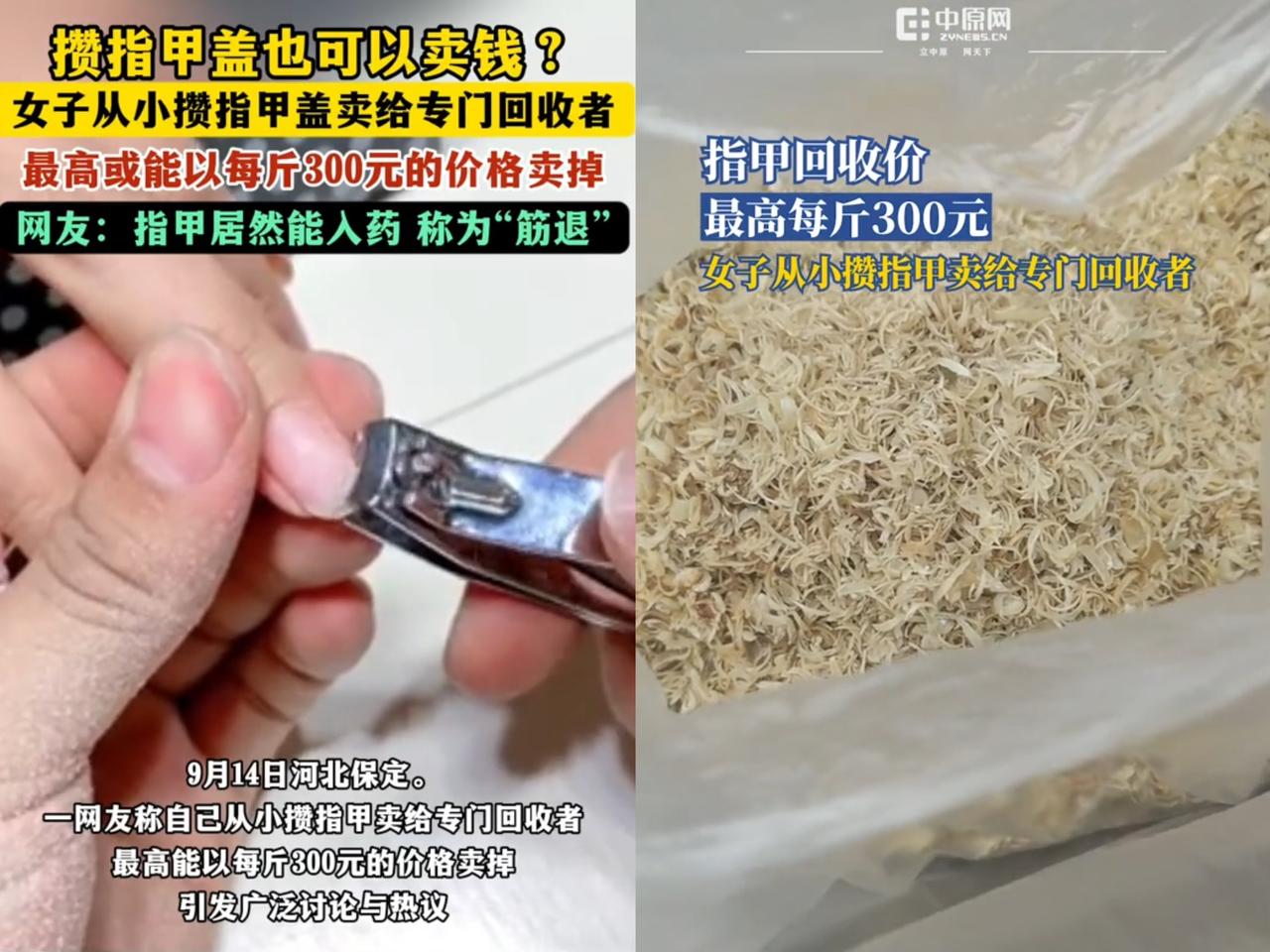 惊不惊喜？意不意外？竟然有人靠攒指甲盖赚钱！河北一女子从小就攒指甲盖，然
