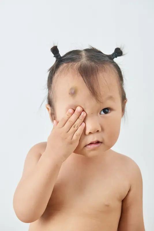 带娃去治疗婴儿血管瘤，那场面真是让人揪心。我家宝宝第一次治疗时，先做了详细检查，