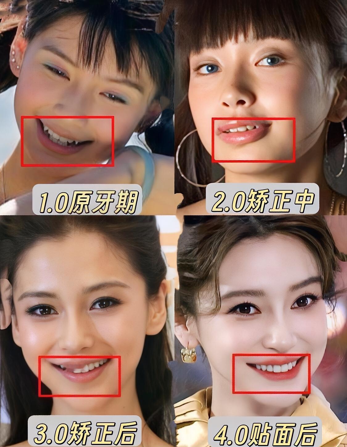 不愧是整牙天花板每日打卡上热门