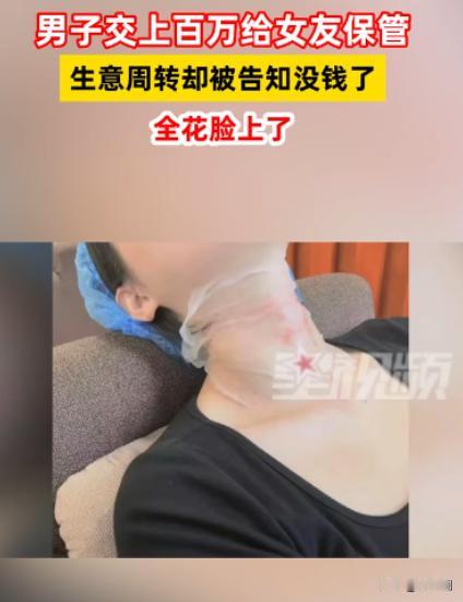 重庆，一男子将130万余元全都交给漂亮女友保管，可女友却在闺蜜的推荐下去做了医美