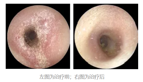 耳朵总是痒, 却啥也掏不出来? 可能暗示这 5 种问题, 快自查