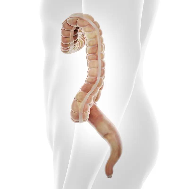 肠癌的罪魁祸首可不止一个。饮食上，过多摄入脂肪、红肉，缺乏膳食纤维，患癌风险会明