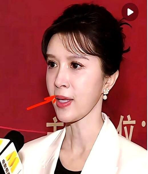 金巧巧的人中，竟然引爆了3.2亿的讨论。很多人抓着她“人中不明显”这点不放，