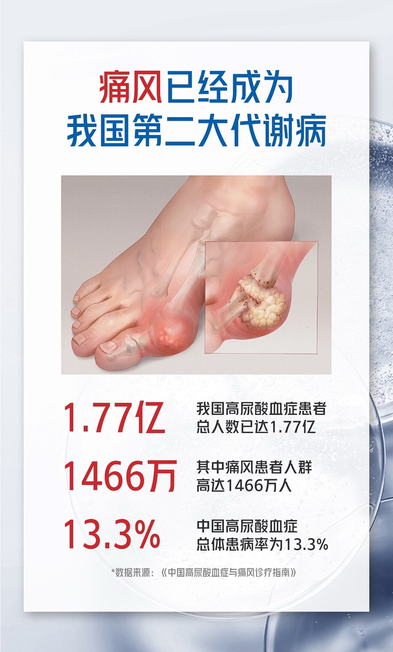 关于痛风，有很多容易被忽略的细节。首先，饮食对尿酸的影响大约只占20%。更大影响
