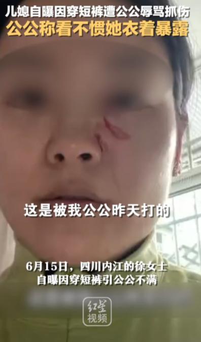 “清官难断家务事！”四川内江，一名儿媳因天气热穿白色短裤在家吃饭，竟被50多岁的