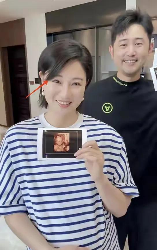 娱乐圈也挺忙的，这两天的好消息一直接连不断，之前有媒体曝出40岁的许玮甯怀孕