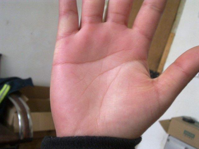 掌纹是健康的晴雨表, 医生: 如果你是这3种, 赶紧去医院检查!