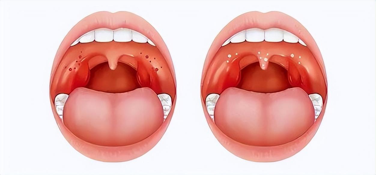 人体最没用的4个器官，割掉反而更好？有的人早就没有了身体里有几个部位叫做"退