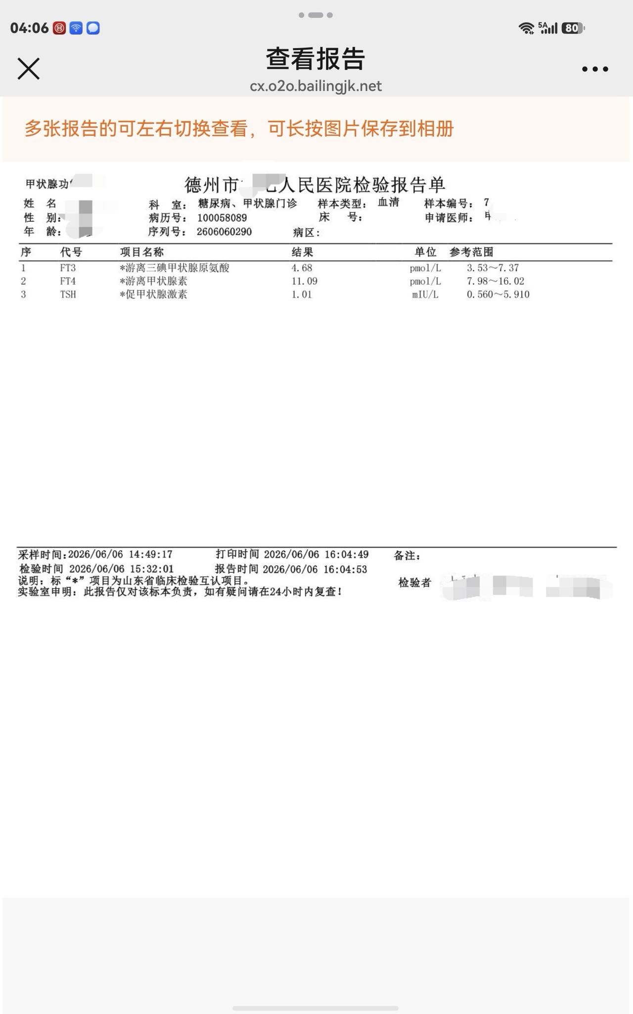 一个甲减患者的最新甲状腺激素检查结果。甲状腺功能低落甲减病甲状腺功能恢