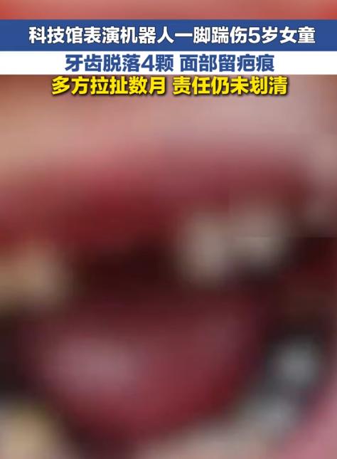 “真是飞来横祸！”8月25日新快报报道，湖北襄阳，5岁小女孩在科技馆看机器人表演