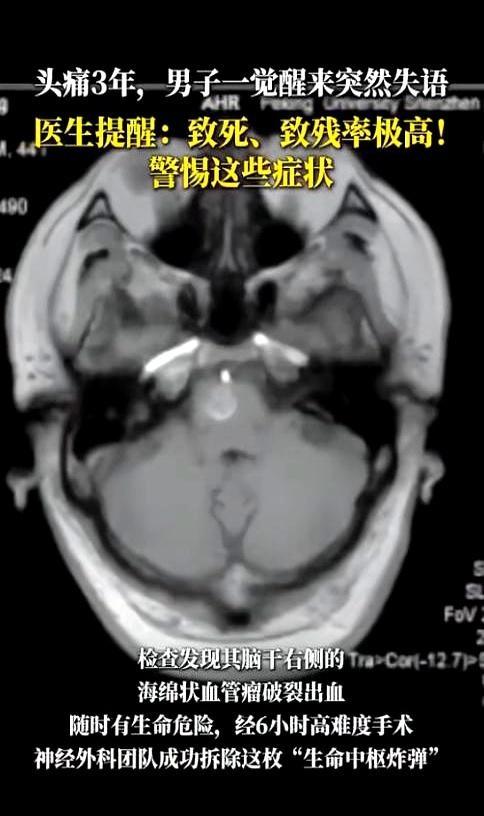 “悲剧还是发生了！”深圳一名44岁打工者把反复头痛当作加班的代价，硬扛了整整三年