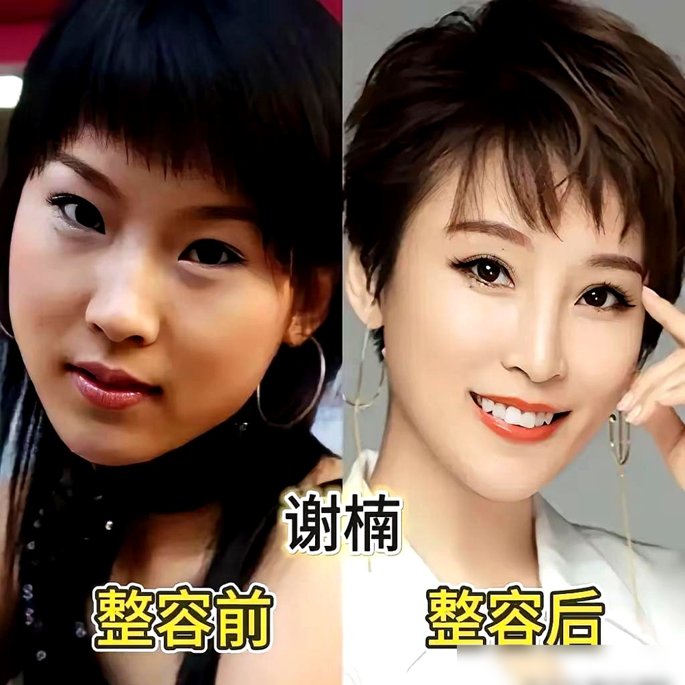 沈梦辰早年选秀旧照被翻出来，肤色黑、脸圆，跟现在简直判若两人。网友直接贴脸开大问是不是整了，她没躲，