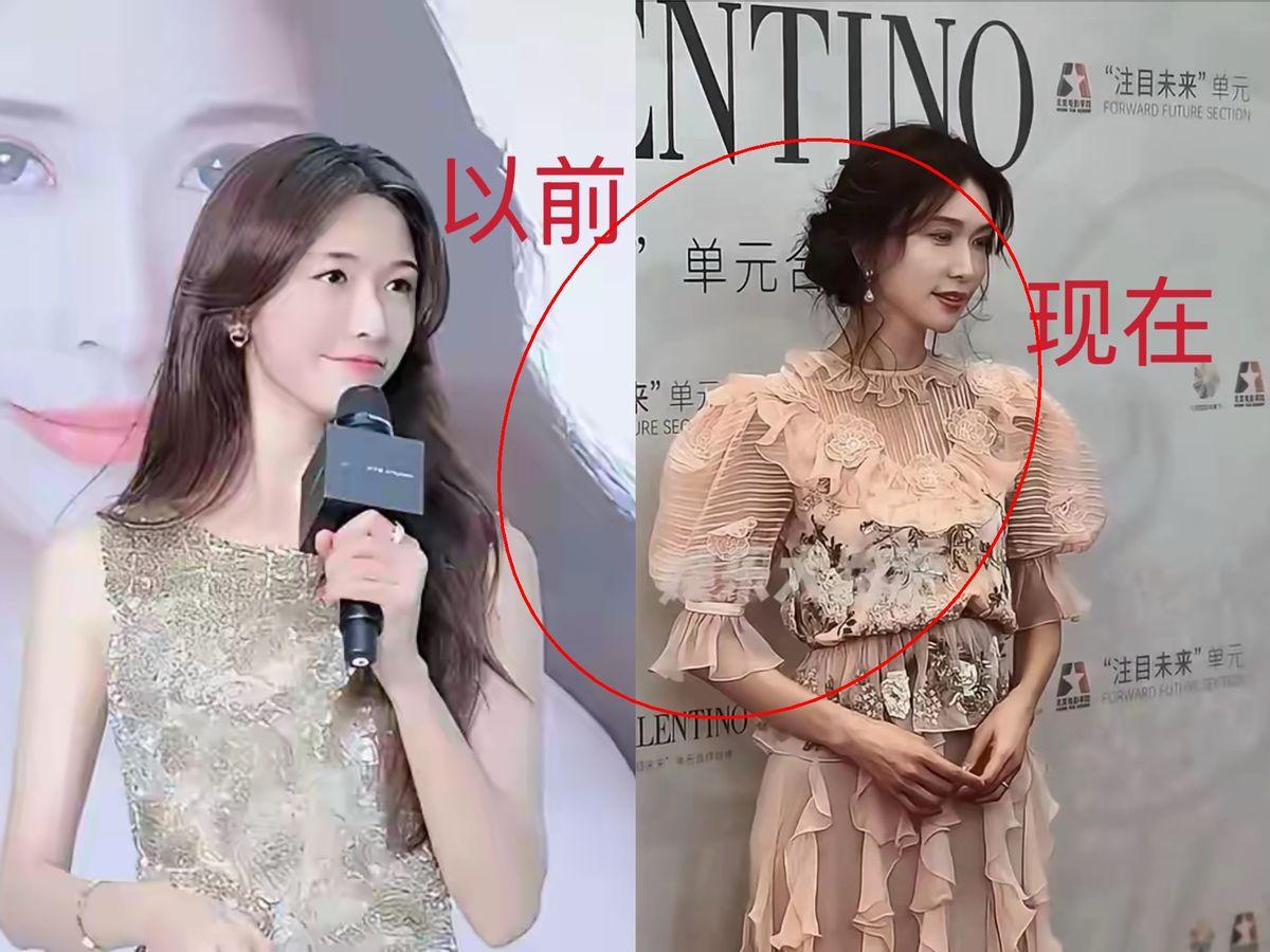 林志玲，实在不行就回来吧🌹嫁给黑泽良平刚满6年现在连腰都直不起来了走路双