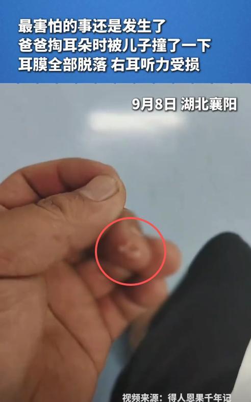 “悲剧还是发生了！”9月8日，湖北襄阳，一男子在家里掏耳朵时，2岁的儿子突然跑过