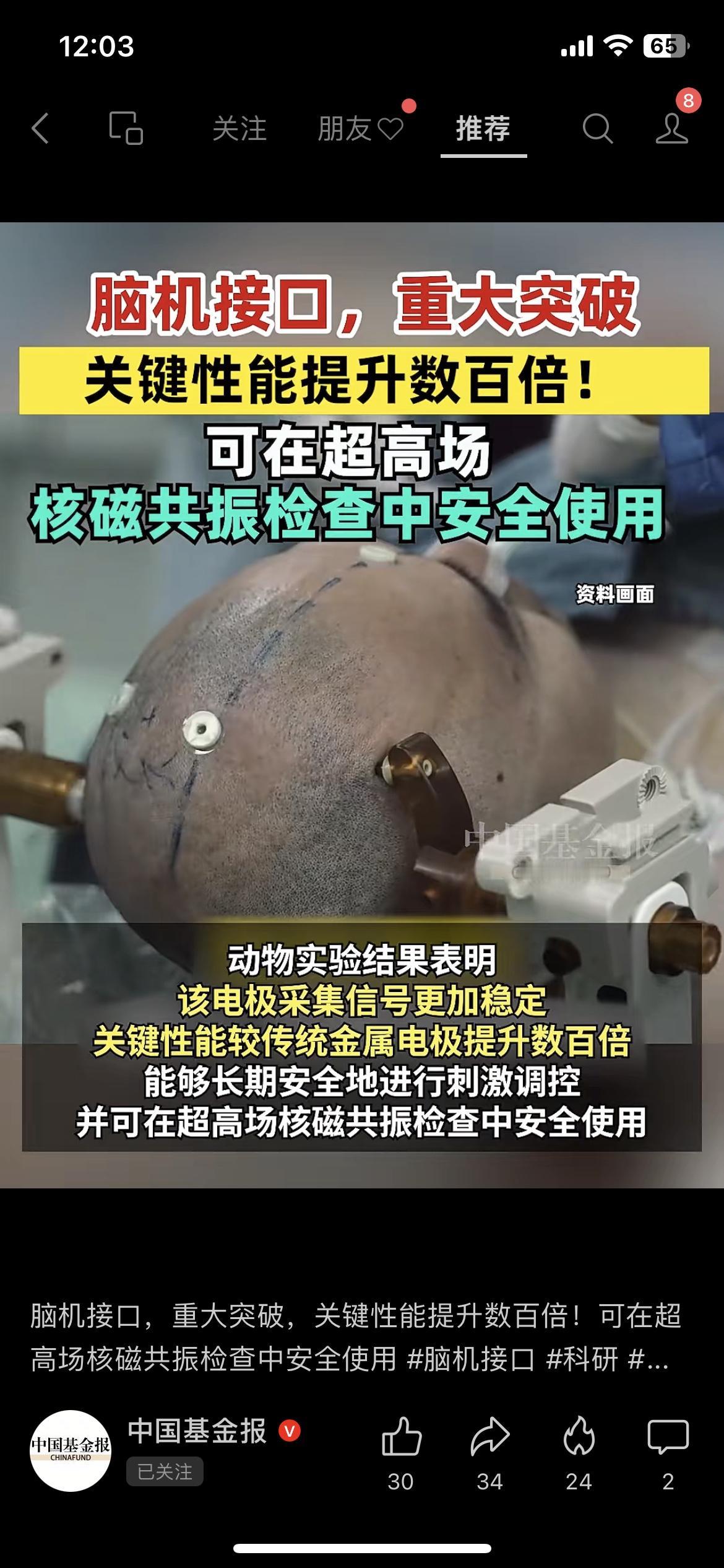 脑机接口重大突破！性能提升数百倍，还能做核磁检查！西北工业大学团队研发的新型电