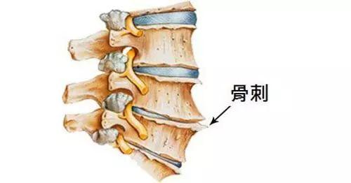 【冬季养生健康生活】走路的时候经常觉得骨头痛? 那是因为......