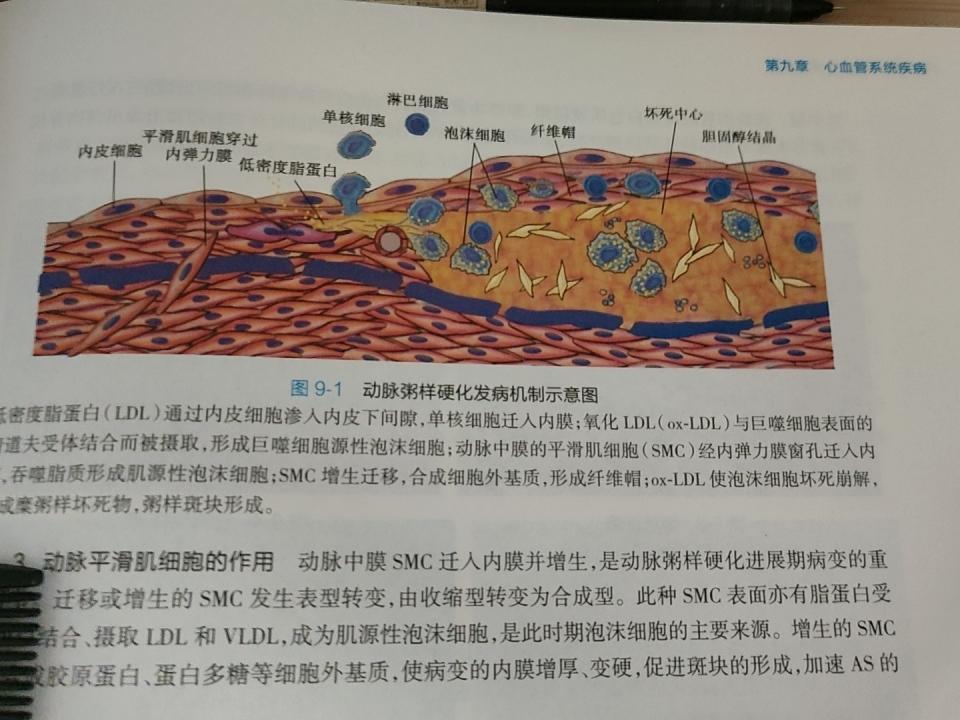 学习完动脉粥样硬化的知识后，我发现周围好多人都有这样的坏习惯。今天，老师在课