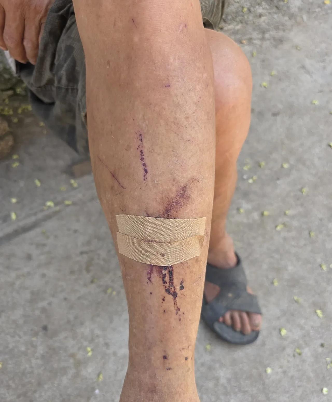 瘆人：我们觉得要命的事，父老乡亲看来不足挂齿……今天上午在北京情报站，跟这里的