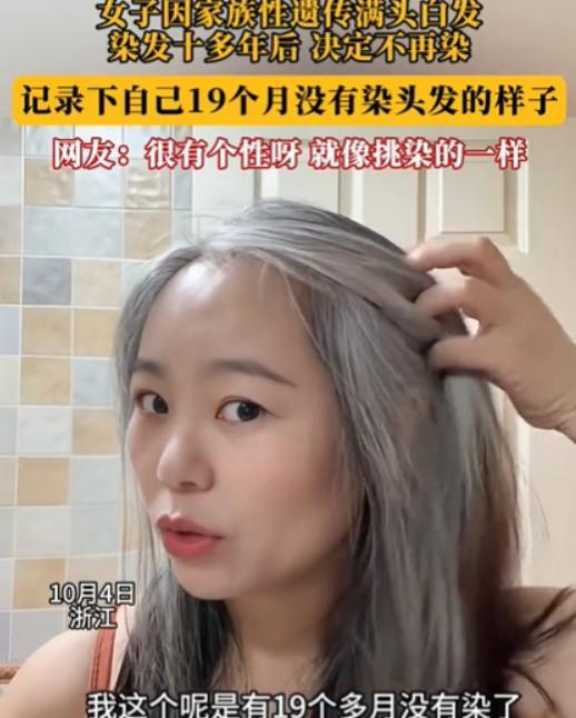 浙江一女子发现几根白发，她本以为拔了就是！万万没想到，仅仅几个月时间，她原本光亮
