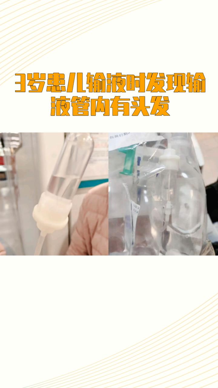 三岁患儿输液时发现输液管内有头发，引发家庭与医院之间的医疗纠纷。近日，市民殷先