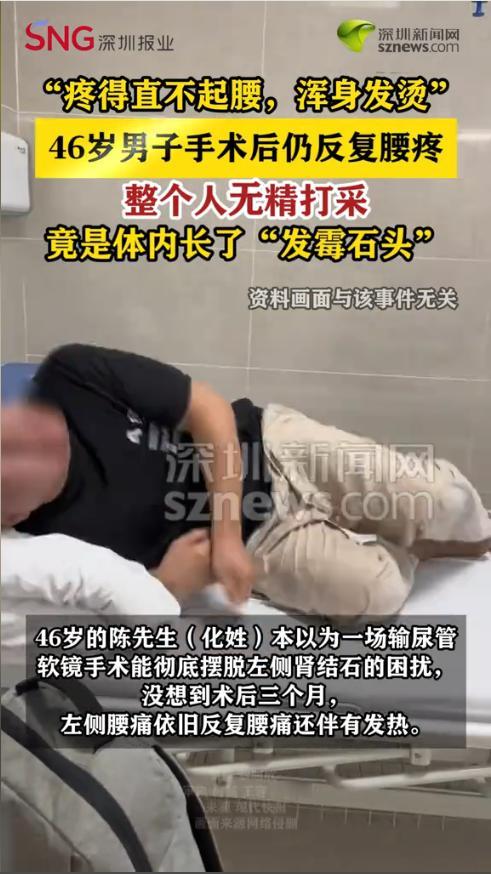 “开眼界了！”近日，江苏南通，一名46岁男子做完结石手术后仍反复腰疼，整个人无精