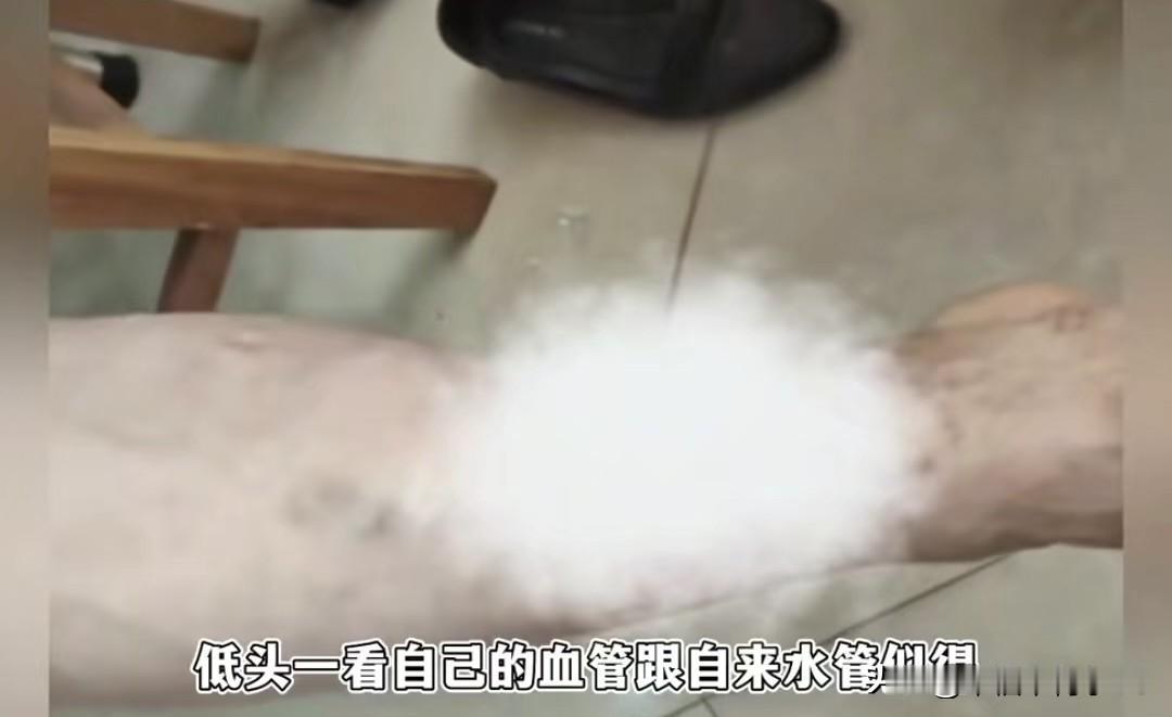 南方大哥到哈尔滨旅游，居然把自己血管冻爆了这对南方情侣来哈尔滨玩，晚上在中