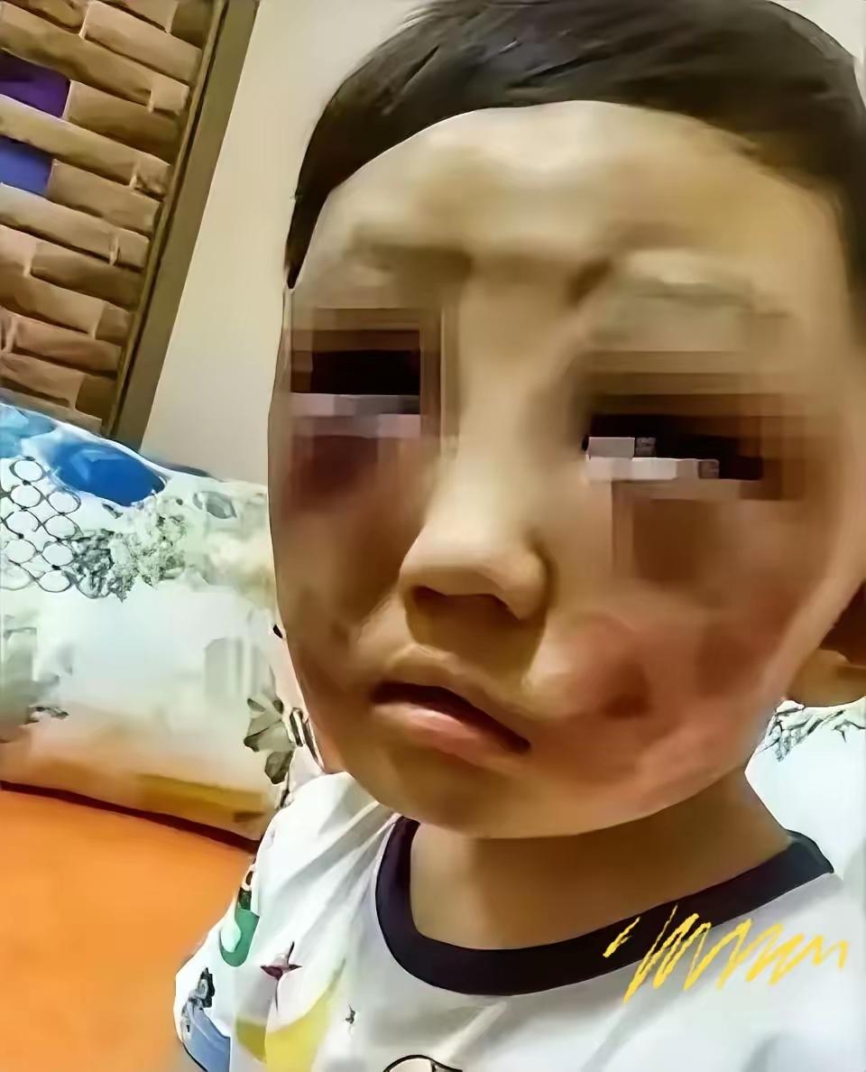 六岁男孩满身伤痕找妈妈，继父一句话看哭无数人父母离婚后，六岁小男孩跟着父亲