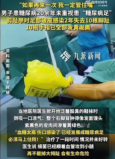 这篇报道生动反映了糖尿病足的严重后果和预防的重要性。以下是我的总结与建议：糖